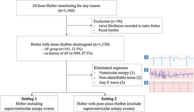 An Artificial Intelligence Algorithm With 24-h Holter Monitoring for the Identification of Occult Atrial Fibrillation During Sinus Rhythm